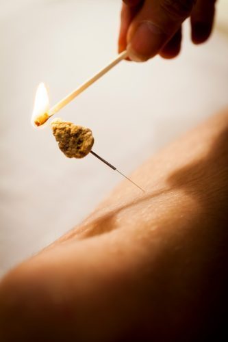 moxibustion-o46vo21m1i13q7iqjdfna5k8qkl0ytxwd0tpgy6ebk moxibustion-o46vo21m1i13q7iqjdfna5k8qkl0ytxwd0tpgy6ebk